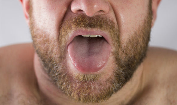 Tongue-cancer-early-signs-1187805.jpg